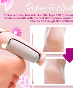 Rechargeable Electric Foot Callus Remover