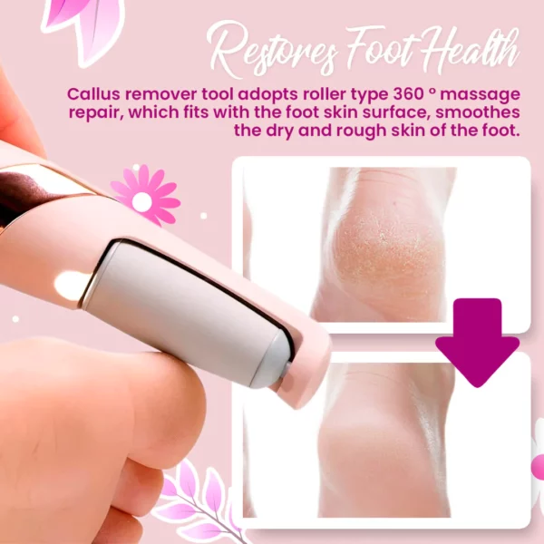 Rechargeable Electric Foot Callus Remover