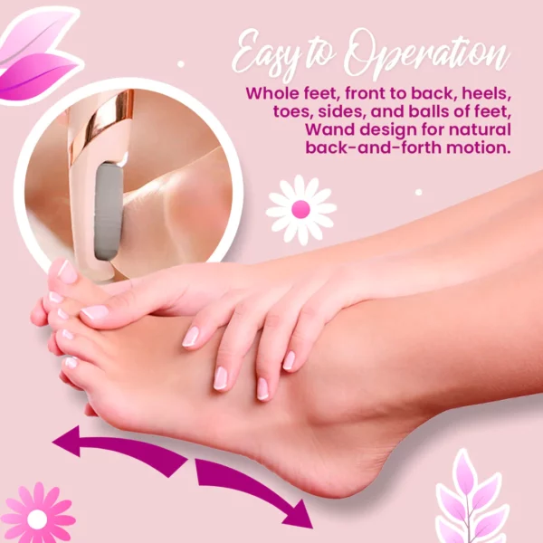 Rechargeable Electric Foot Callus Remover