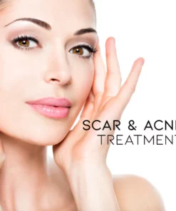 Scar & Acne Bump Removal Cream