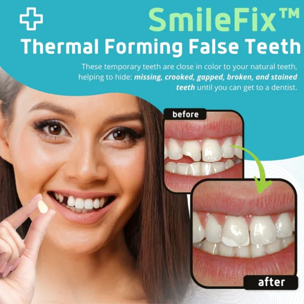 SmileFix™ Thermal Forming False Teeth