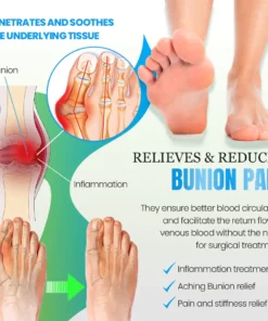 Sofeet™ Bunion Cure Health Sock