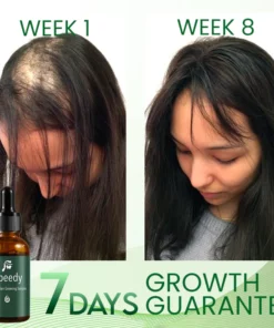 Speedy 7Days Hair Growing Serum