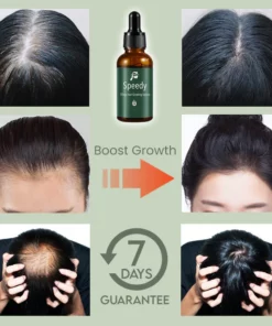 Speedy 7Days Hair Growing Serum