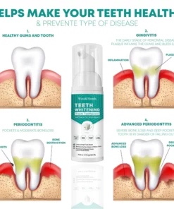 StainOff TeethWhitening Mousse Toothpaste