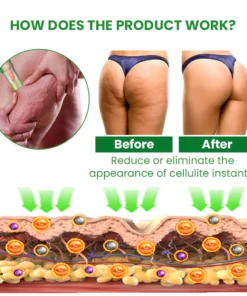 SusoSkin 2 In 1 Herbal Cellulite Soothing Balm