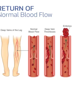 VeinesHeal Thermotherapeutic Sock