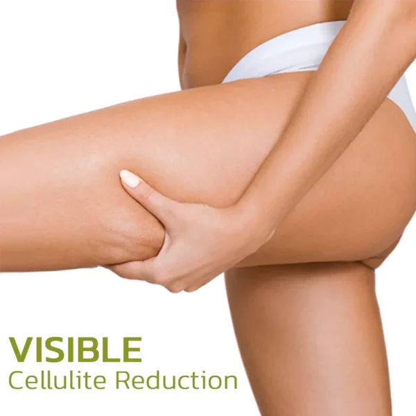 XHerbalLegs Cellulite Reduction Patches