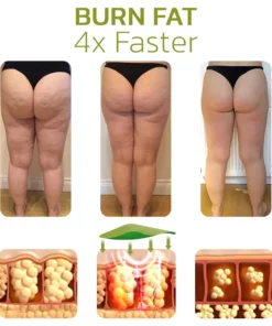 XHerbalLegs Cellulite Reduction Patches