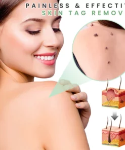 AMORIE Peau SKINTAG'Gone Patch