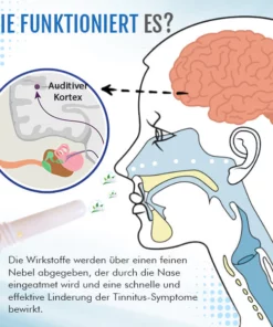 Avaent™ Tinnitus-Soforthilfe Nasal-Inhaler