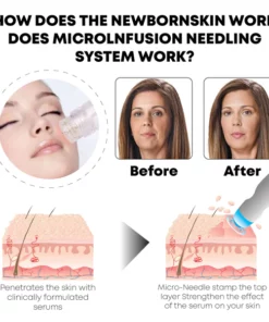 BabySkin MicroInfusion AgelessSystem