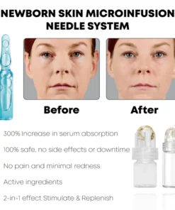 BabySkin MicroInfusion AgelessSystem