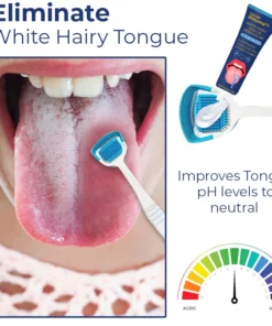 Canada Bioluma™ White Hairy Tongue Removal Kit