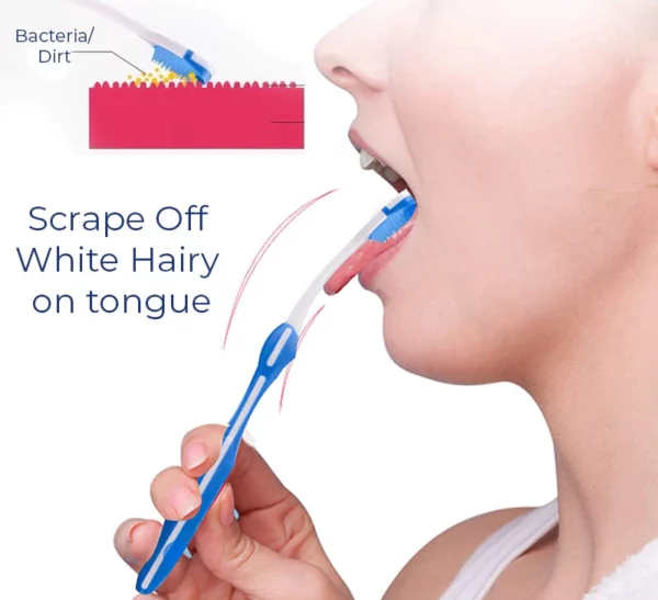 Canada Bioluma™ White Hairy Tongue Removal Kit