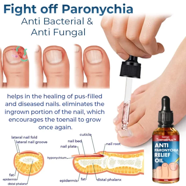 Flysmus™ German Anti Paronychia Relief Oil