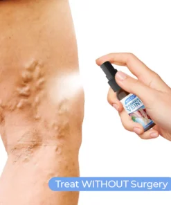 MEDix™ Varicose Veins Spray