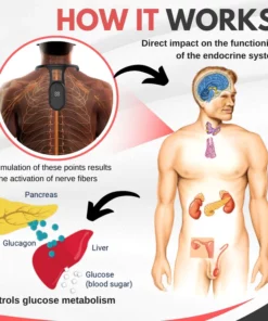 Mericle™ Sugar Control Acupressure Neck Device