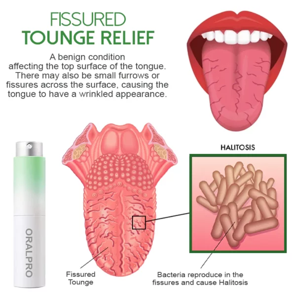 OralPro Fissured Tongue Relief Spray