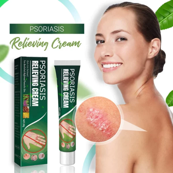 Psoriasis Relieving Cream