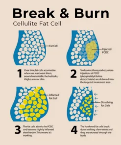 Sci-Effect™ Sonic Cellulite Buster