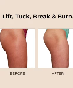 Sci-Effect™ Sonic Cellulite Buster