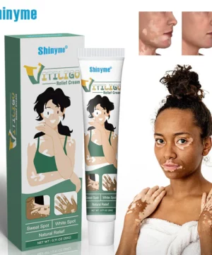 Shinyme Vitiligo Skin Repair Cream