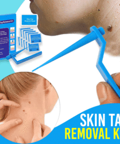 Skin Tag Remover Kit