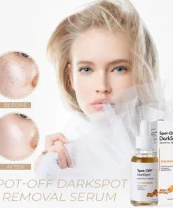 Spot-OFF™ DarkSpot Removal Serum