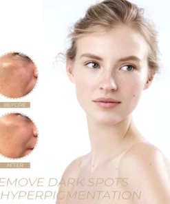 Spot-OFF™ DarkSpot Removal Serum