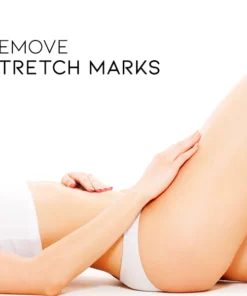 Stretch Mark Repairing Serum