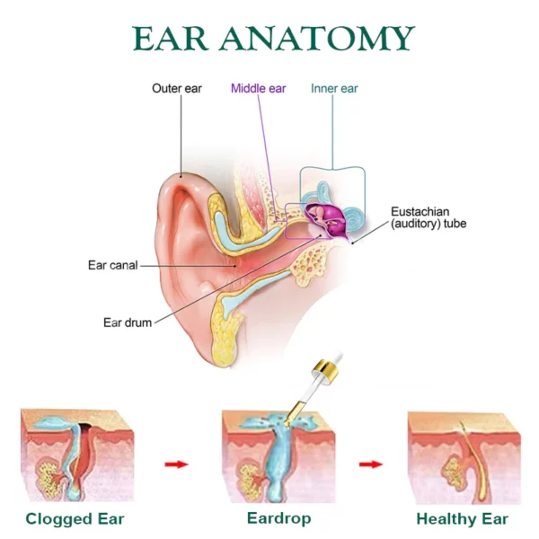 TinnitusRELIEF RingingEliminate EarDrops