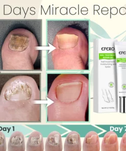 Toe Be Health 7 Days Treatment Gel