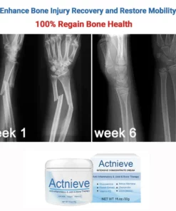 Actnieve™ Anti-Inflammatory & Joint & Bone Therapy Cream