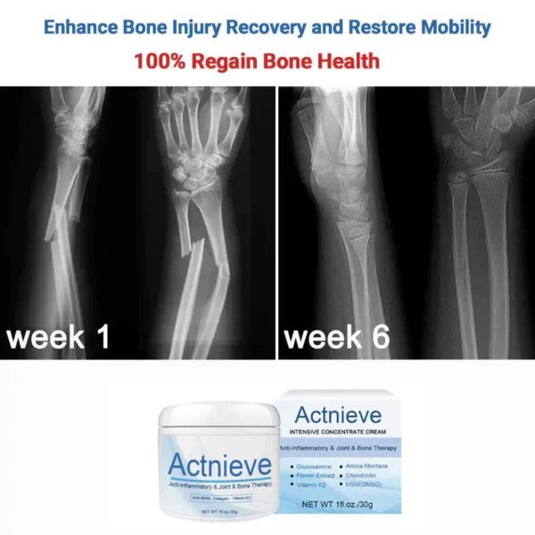 Actnieve™ Anti-Inflammatory & Joint & Bone Therapy Cream