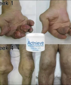 Actnieve™ Anti-Inflammatory & Joint & Bone Therapy Cream