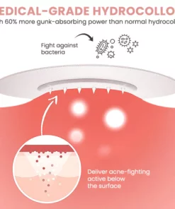 Blusoms™ AcneAtelier Microneedles Patch