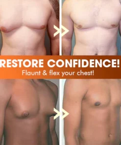 ChestFit™ Gynecomastia Fat Burner Spray