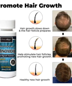 Oveallgo™ Minoxidil Hair Regrowth Treatment