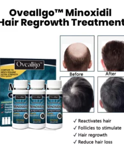 Oveallgo™ Minoxidil Hair Regrowth Treatment