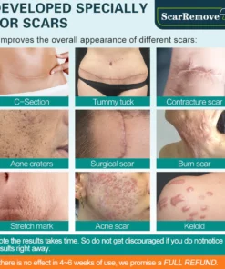 ScarRemove™ Advanced Scar Spray