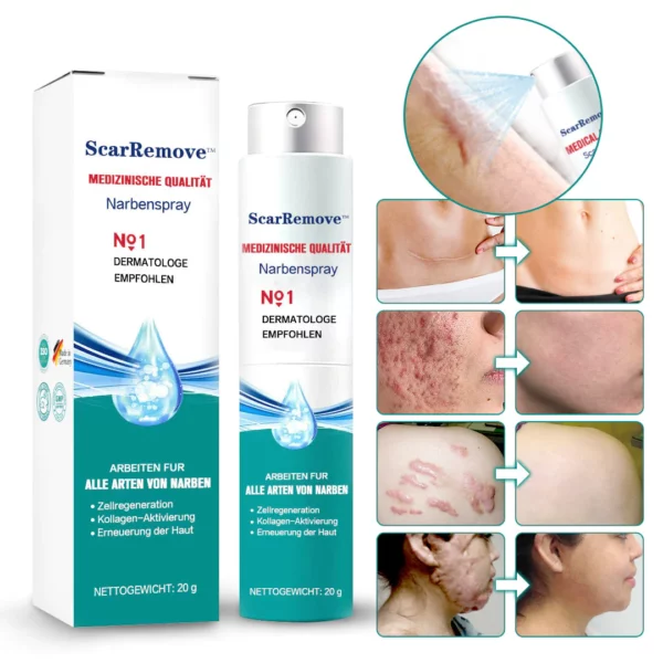 ScarRemove™ Fortgeschrittenes Narbenspray für alle Arten von Narben - Image 4