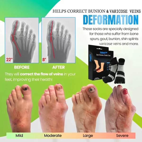 Sofeet™ Anti Bunions & Varicose Veins Health Sock