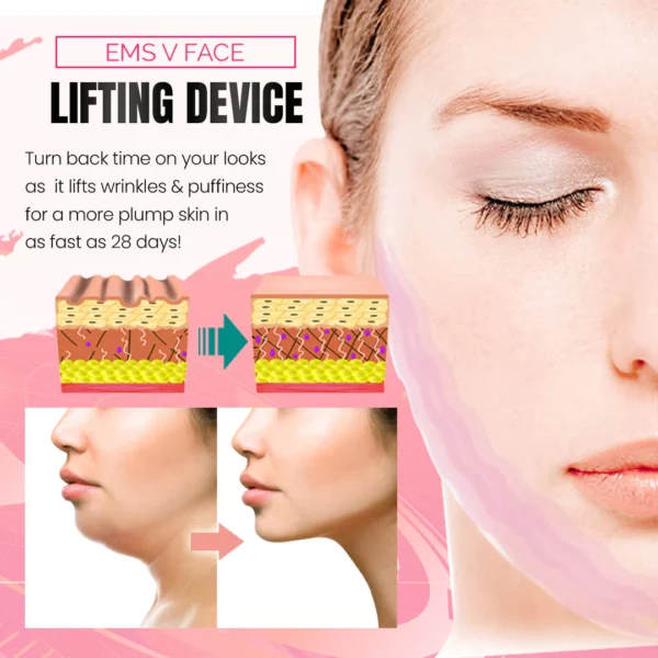 VBeauty™EMS V Face Lifting Device