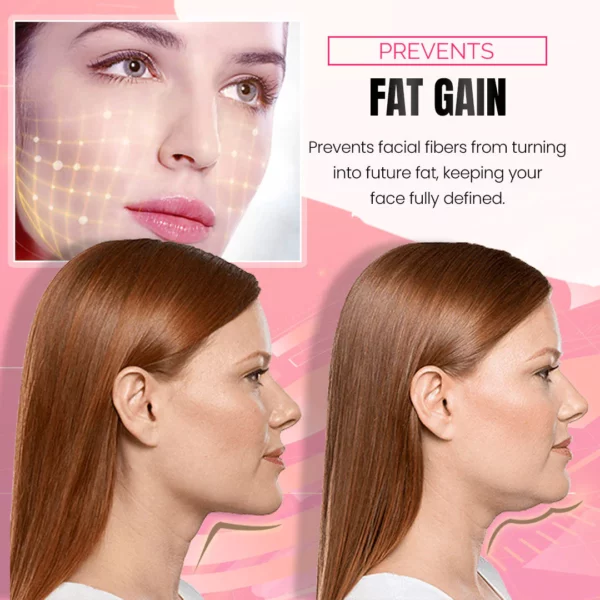 VBeauty™EMS V Face Lifting Device