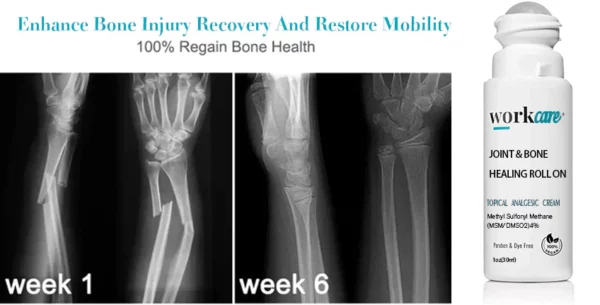 Workcare ™ Joint & Bone Healing Roll On