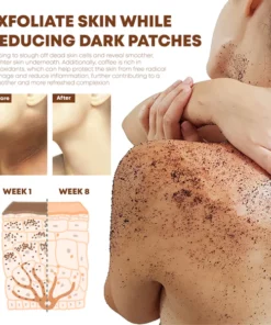 ATTDX Coffee Acanthosis Nigricans BodyScrub