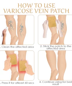 ATTDX InstantRelief VaricoseVein Herbal Patch