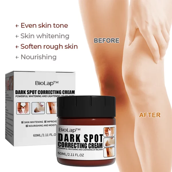 BioLap™ Dark Spot Correcting Cream - Image 2