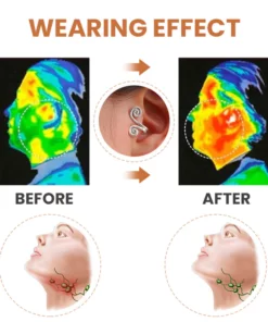 Lumiere™ Ears Acupressure Slimming Earrings